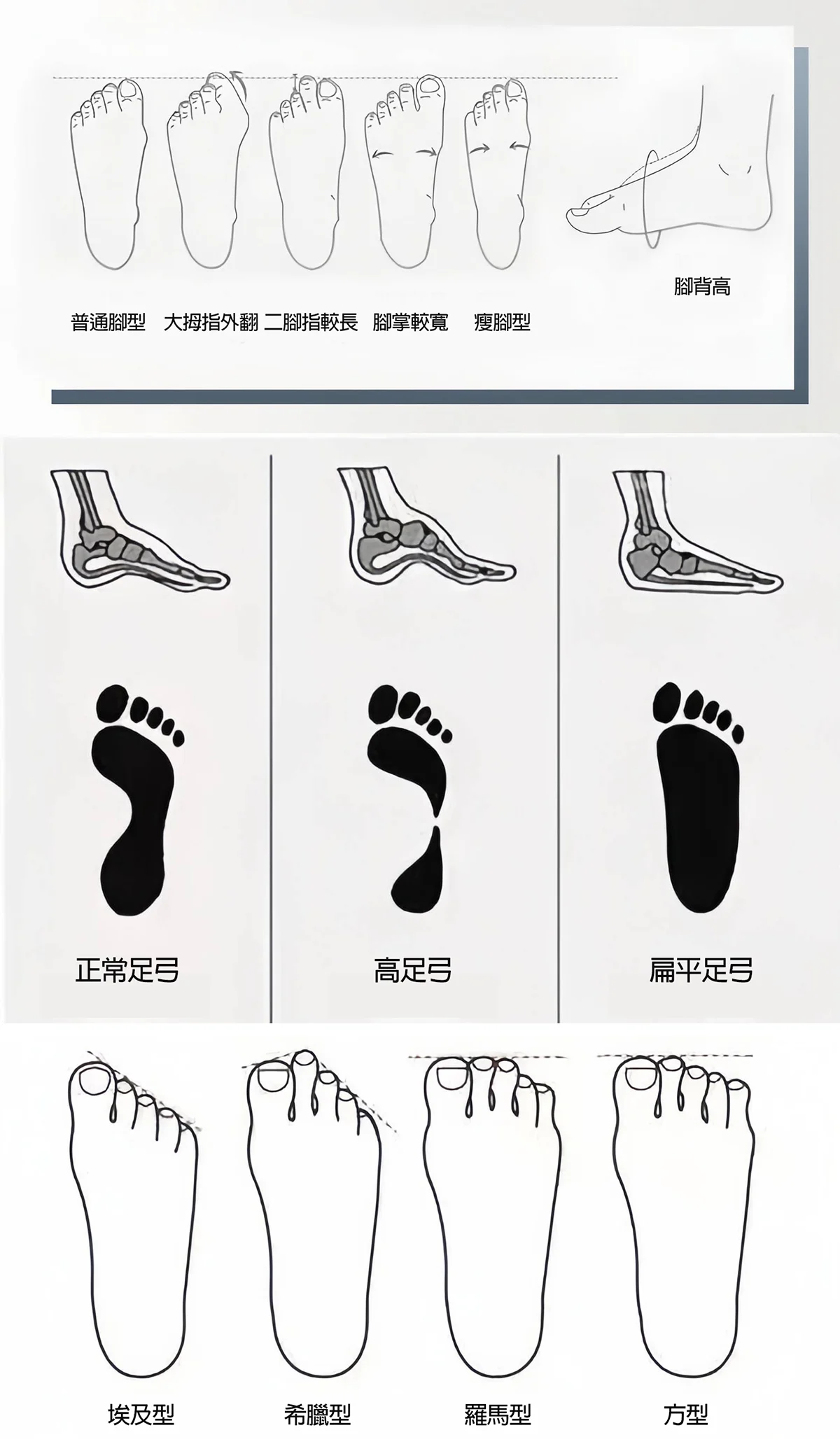 腳型說明圖
